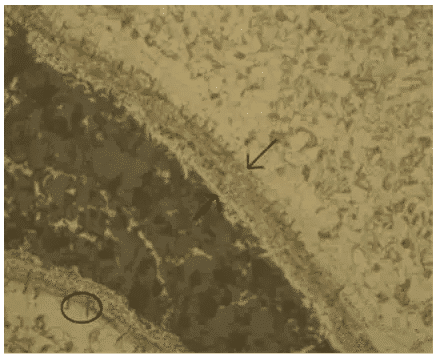 CARACTERíSTICAS Y DIFERENCIAS DEL QUACKCHING CRACK Y FORJING CRACK 5 Observación microscópica